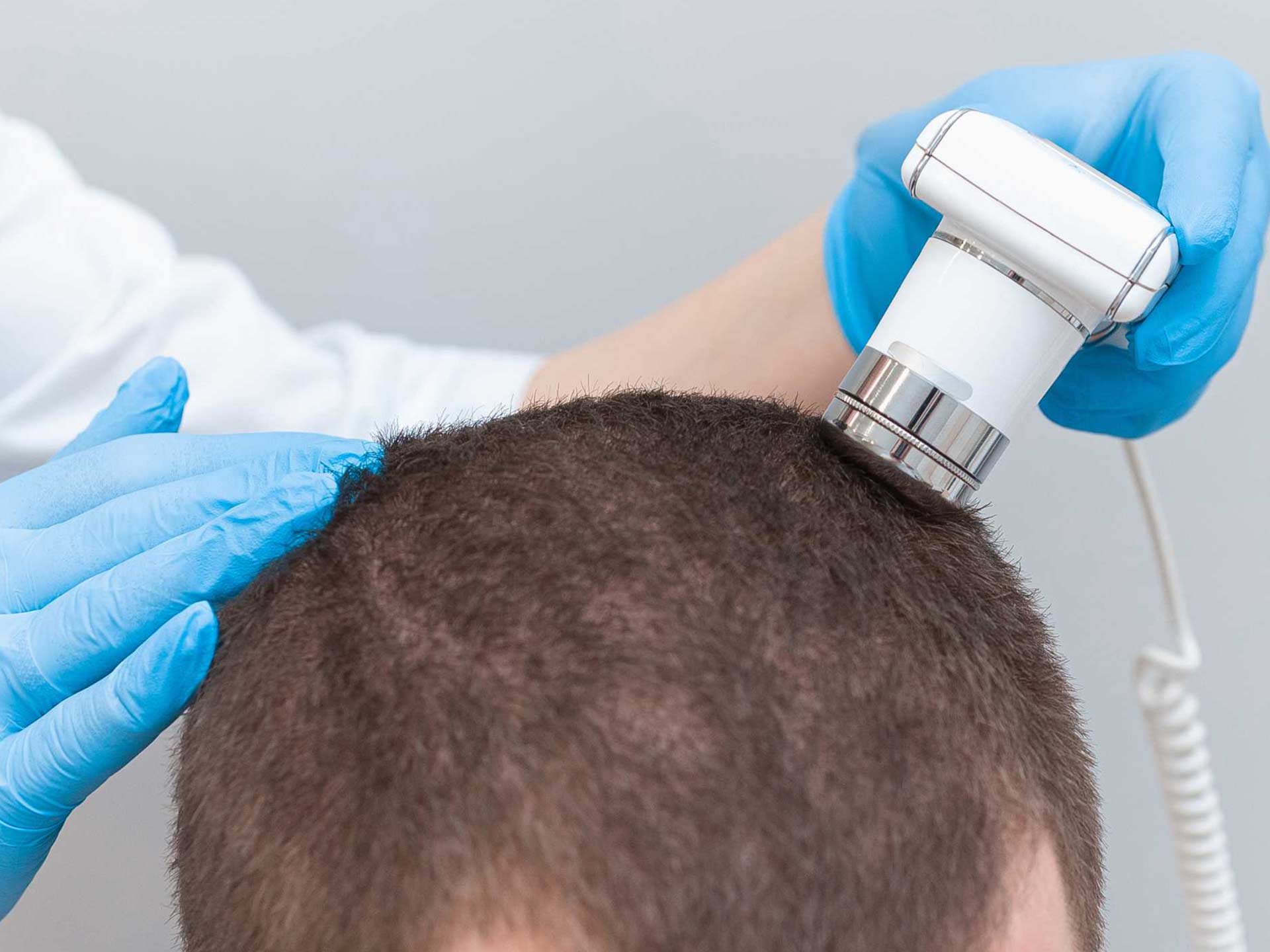 Recuperación del cabello en integria clínica