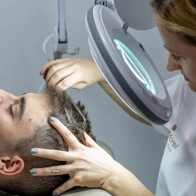 injerto capilar granada